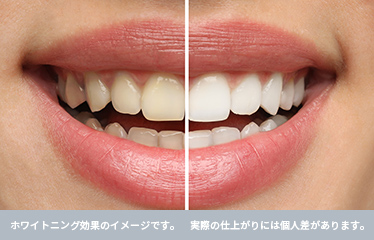 効果が持続しやすい