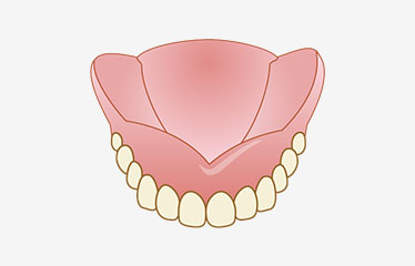コンフォート義歯