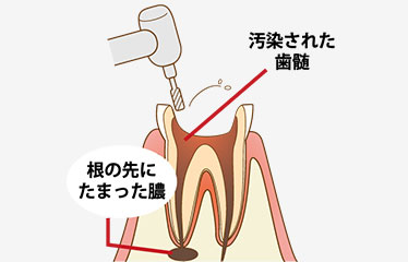 清掃・消毒