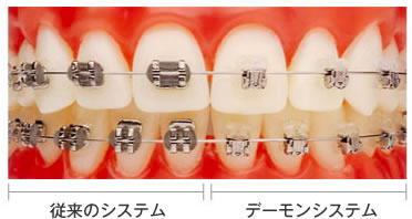 デーモンシステム