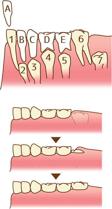 乳歯について アリオ北砂歯科クリニック