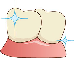歯のイラスト