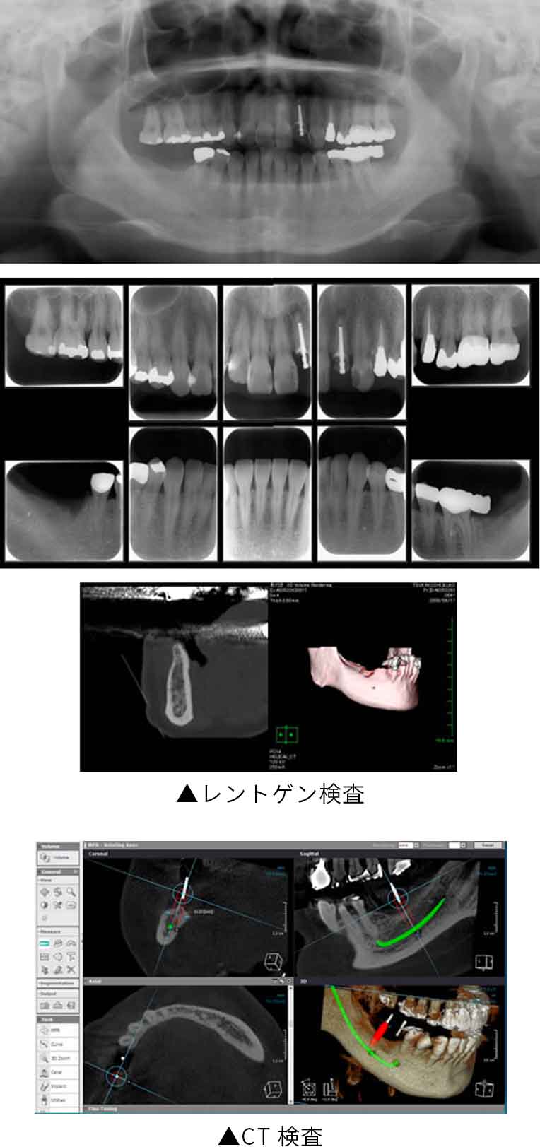 検査