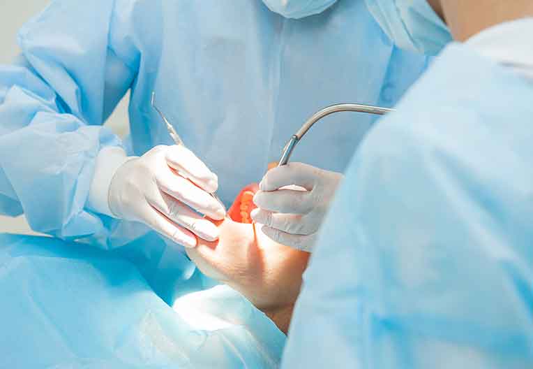 抜歯即時インプラントでもフラップレス手術が可能