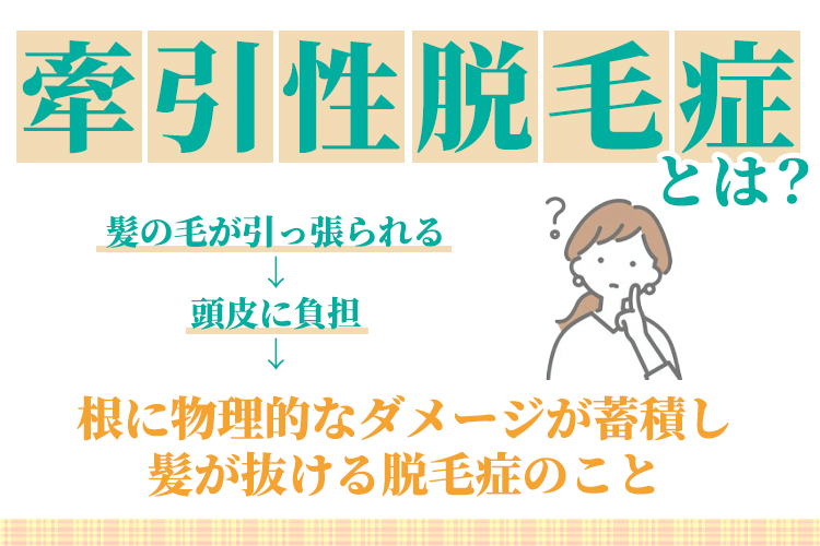 牽引性脱毛症とは？