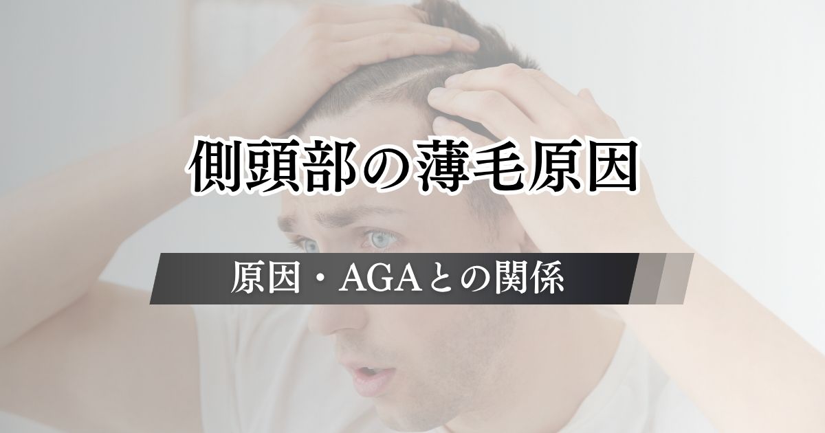側頭部の薄毛はなぜ起こる?原因やAGAとの関係を詳しく解説