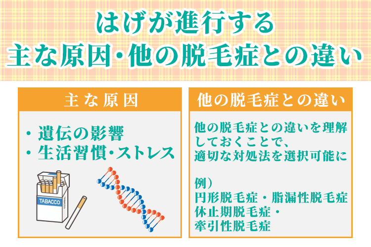 はげが進行する主な原因と他の脱毛症との違い