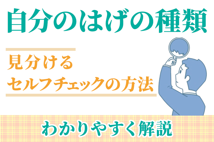自分のはげの種類を見分けるセルフチェックの方法