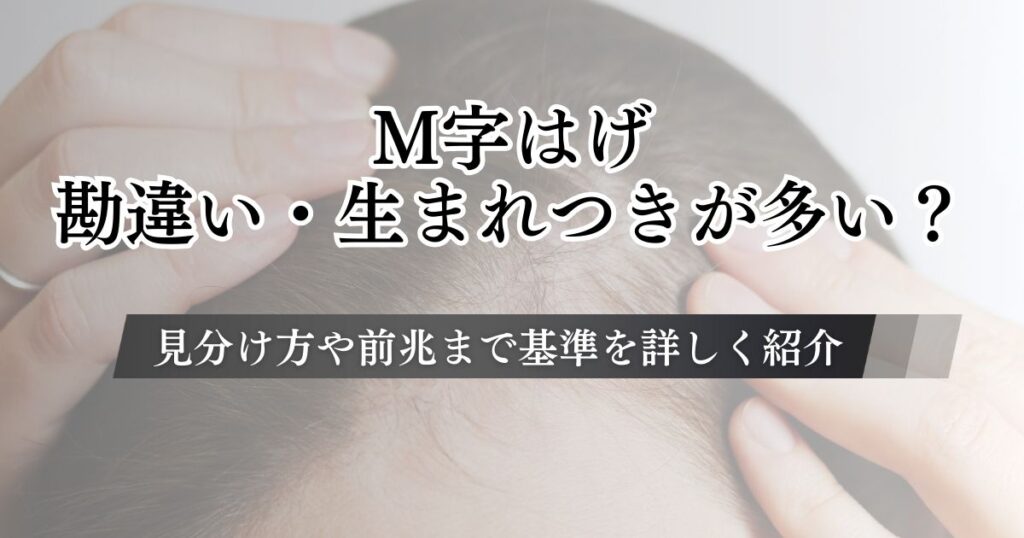 M字はげは勘違い・生まれつきが多い？見分け方や前兆まで基準を詳しく紹介