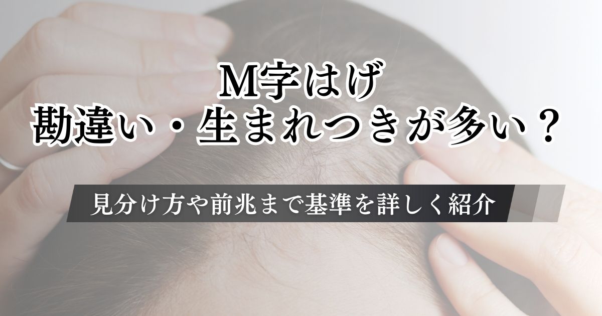 M字はげは勘違い・生まれつきが多い?見分け方や前兆まで基準を詳しく紹介