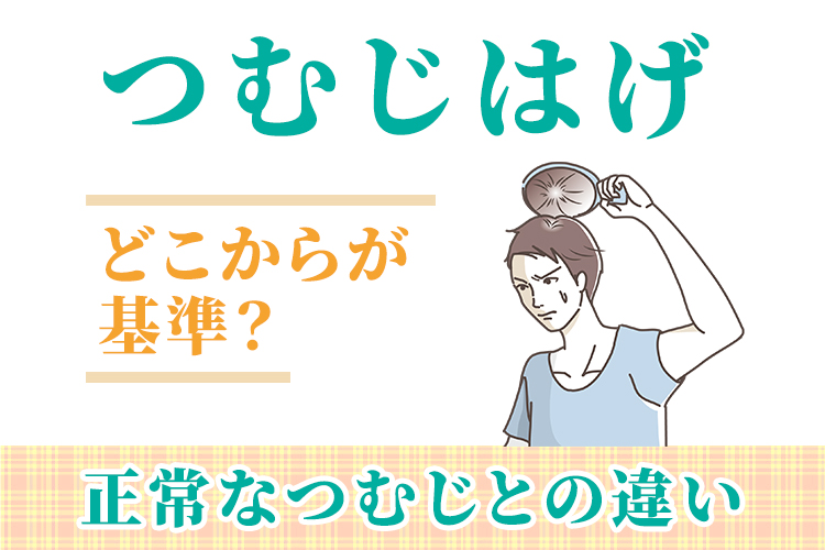 つむじはげはどこからが基準？正常なつむじとの違い