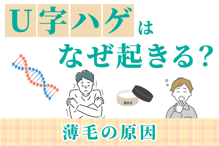 U字ハゲはなぜ起きる？薄毛の原因