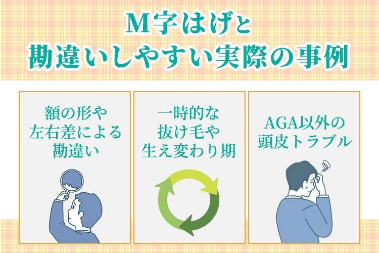 M字はげと勘違いしやすい実際の事例