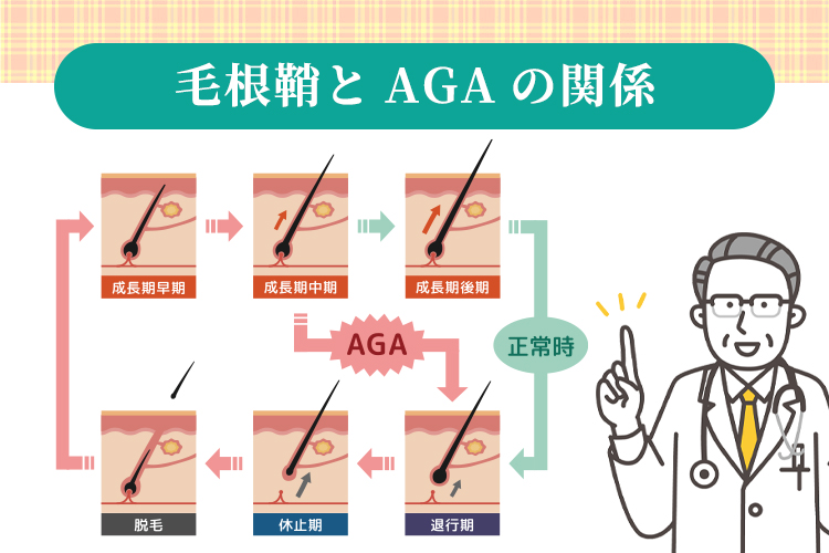 毛根鞘とAGAの関係
