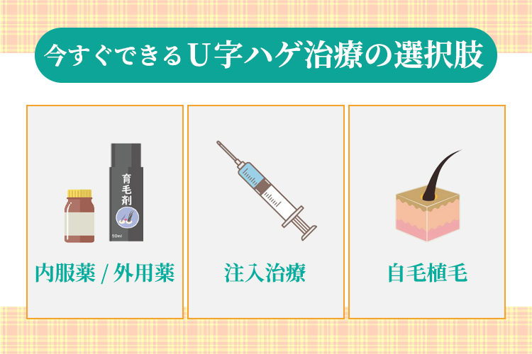 今すぐできるU字ハゲ治療の選択肢
