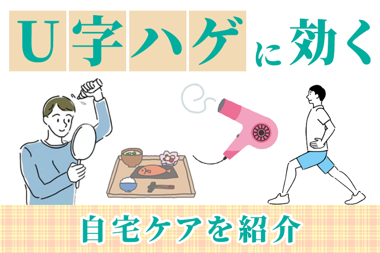 U字ハゲに効く自宅ケアを紹介