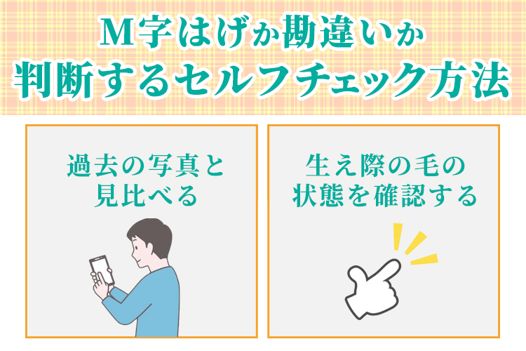 M字はげか勘違いかを判断するセルフチェック方法