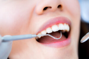 dental_cleaning_01